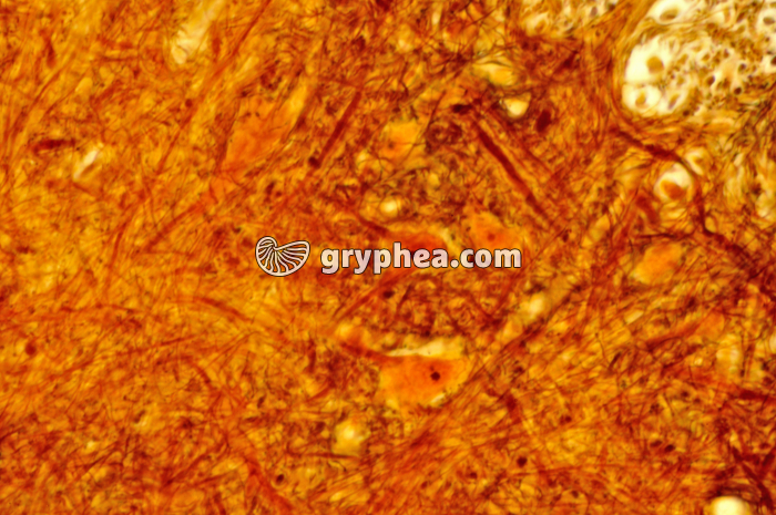 Moelle épinière x160 - gryphea.com